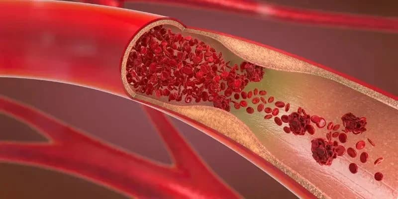 Immagine articolo La Funzione Endoteliale